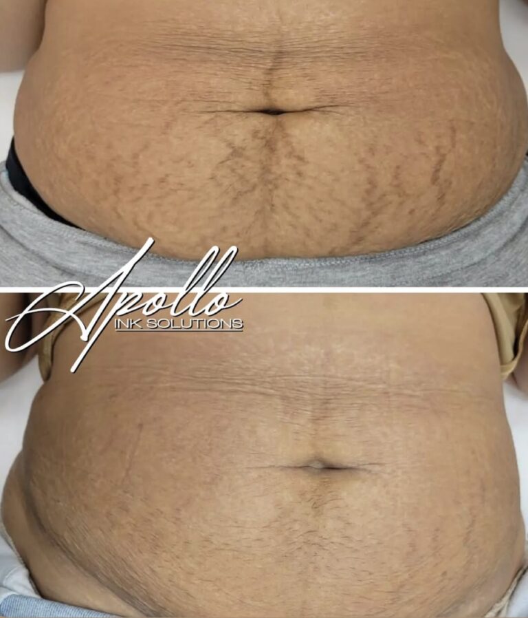 9CA4B549-82F8-4420-AF59-EA439FAD7A50