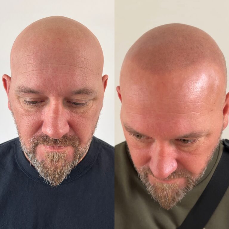 E46DA2C5-616C-4917-90BC-84794AC15745